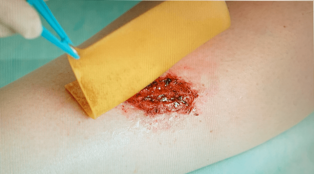 what is medical honey used for